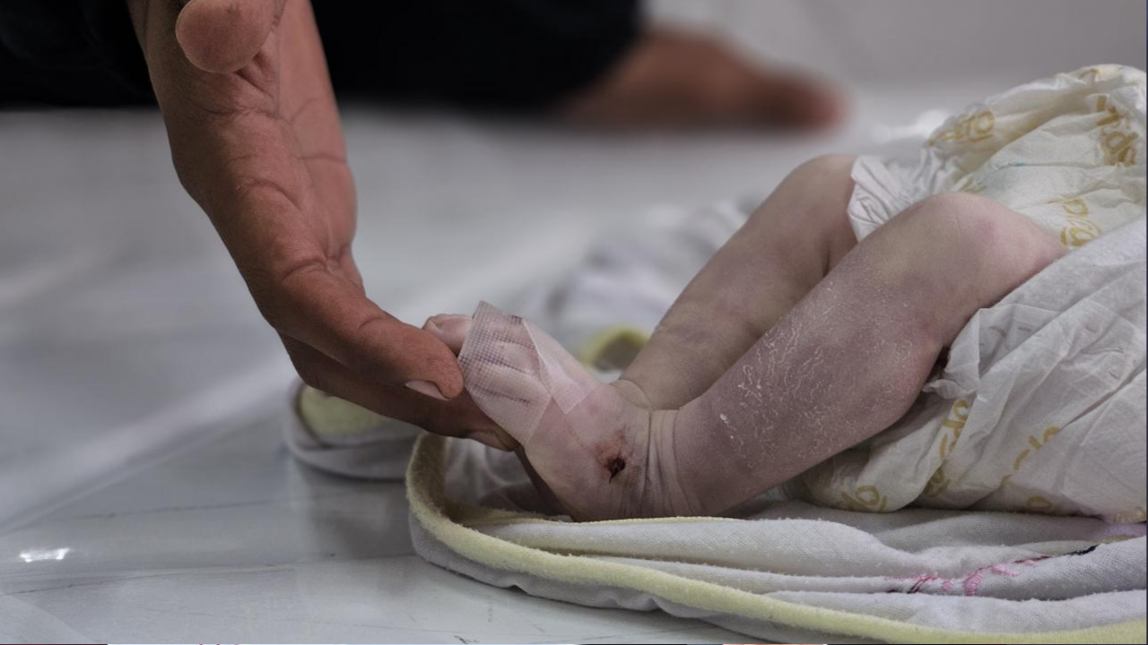 Acılı baba: Dünya Gazze'ye bir kutu mama gönderemiyorsa hepimiz öleceğiz