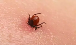 Kene Kayseri'de aynı mahallede 3. defa can aldı!