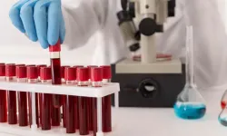 Mikroplastikleri kandan atmanın yeni yolu: Filtrasyon!