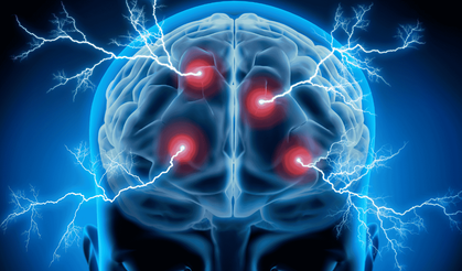 Beyin kanaması gençlerde artıyor